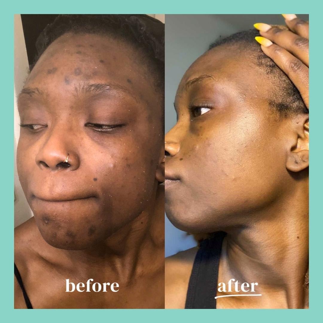 🍊 Gommage Éclat Orange 3-en-1 – Visage, Corps & Pieds