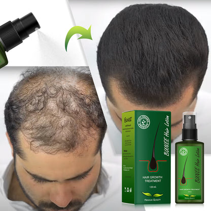 🌿 Sérum Capillaire Bio à la Biotine – Anti-Chute & Repousse Rapide