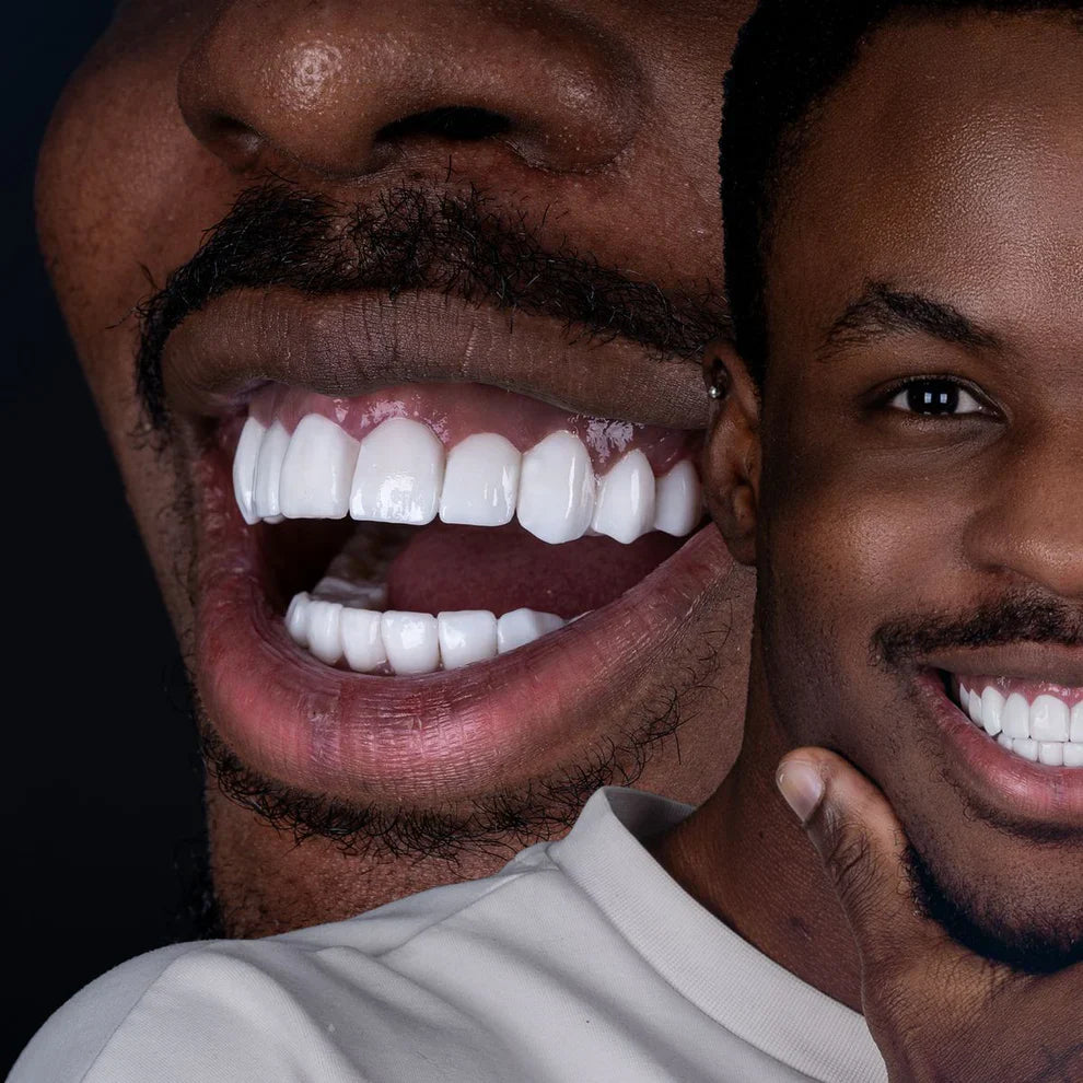 💧Nettoyeur Dentaire Pro - Votre Sourire Plus Sain au Quotidien
